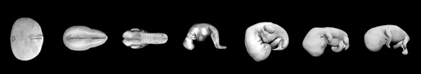 human-embryo-1